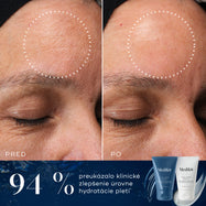 Porovnanie čela účastníka pred a po ošetrení, zobrazené vedľa tubiek Medik8 H.E.O. Mask Step 1 a Step 2. Na obrázkoch je viditeľné zníženie jemných vrások a hladšia textúra pleti. Text zdôrazňuje, že u 94 % účastníkov došlo k klinickému zlepšeniu úrovne hydratácie pokožky.