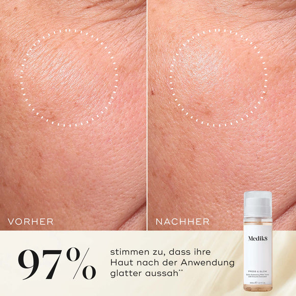 Nahaufnahme der Wange einer Teilnehmerin vor und nach der Anwendung, die eine glattere Textur und ein gleichmäßigeres Erscheinungsbild zeigt. Die Medik8 Press & Glow-Tonikflasche ist in der Ecke zu sehen. Der Text hebt hervor: „97 % stimmen zu, dass ihre Haut nach der Anwendung glatter aussah.“-hover-44