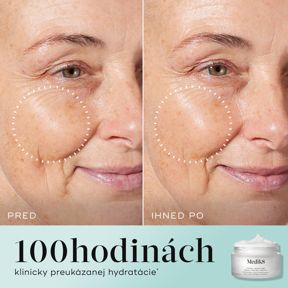 Total Moisture Daily Facial Cream™ 50ml hover