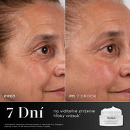 7 dní – Porovnanie stavu oblasti okolo očí účastníka pred a po 7 dňoch zobrazené vedľa balenia krému Medik8 Advanced Pro-Collagen+ Peptide Cream. Text zdôrazňuje, že je klinicky preukázané, že tento produkt viditeľne znižuje hĺbku vrások za 7 dní.

28 dní – Porovnanie tváre účastníčky pred a po 28 dňoch zobrazené vedľa nádobky s krémom Medik8 Advanced Pro-Collagen+ Peptide Cream. Text zdôrazňuje klinicky preukázané výsledky v oblasti hladkosti, pevnosti a textúry.