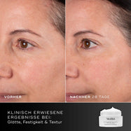 Porovnanie tváre účastníčky pred a po 28 dňoch, zobrazené vedľa balenia krému Medik8 Advanced Pro-Collagen+ Peptide Cream. Text zdôrazňuje klinicky preukázané výsledky v oblasti hladkosti, pevnosti a štruktúry pokožky.