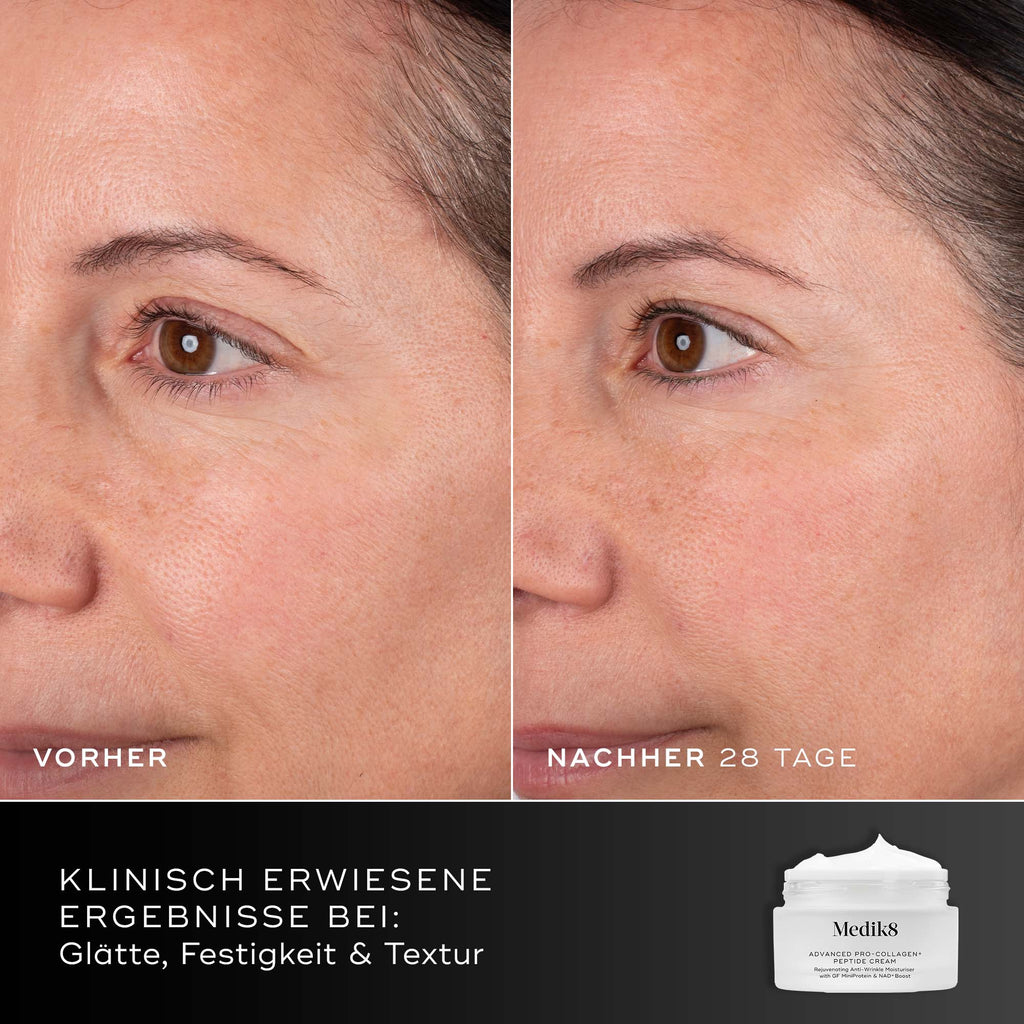 Porovnanie tváre účastníčky pred a po 28 dňoch, zobrazené vedľa balenia krému Medik8 Advanced Pro-Collagen+ Peptide Cream. Text zdôrazňuje klinicky preukázané výsledky v oblasti hladkosti, pevnosti a štruktúry pokožky.
