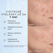 Porovnanie detailných záberov na líce pred aplikáciou a po 4 týždňoch zobrazuje viditeľné zmiernenie začervenania a nedokonalostí textúry, čo dopĺňa text pod nimi s informáciou, že produkt je klinicky overený na redukciu viditeľného začervenania a zlepšenie zdravia kožnej bariéry.
