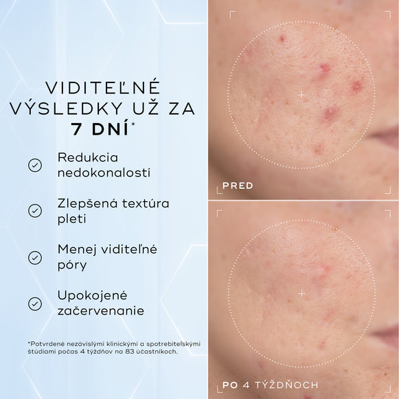 Porovnanie detailných záberov na líce pred aplikáciou a po 4 týždňoch zobrazuje viditeľné zmiernenie začervenania a nedokonalostí textúry, čo dopĺňa text pod nimi s informáciou, že produkt je klinicky overený na redukciu viditeľného začervenania a zlepšenie zdravia kožnej bariéry.-hover-25