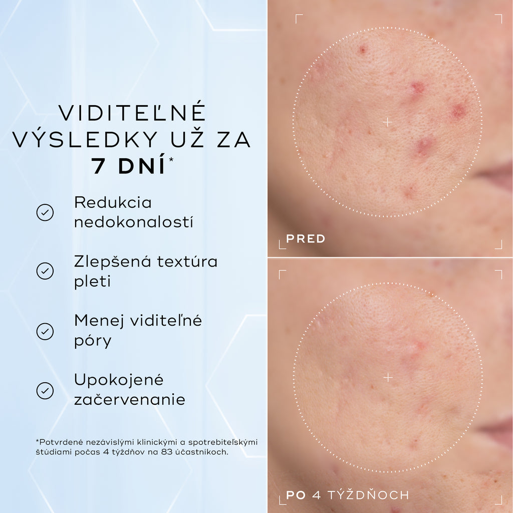 Porovnanie detailných záberov na líce pred aplikáciou a po 4 týždňoch zobrazuje viditeľné zmiernenie začervenania a nedokonalostí textúry, čo dopĺňa text pod nimi s informáciou, že produkt je klinicky overený na redukciu viditeľného začervenania a zlepšenie zdravia kožnej bariéry.